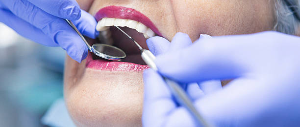 Best Emergency Wisdom Teeth Removal in Newcomerstown, OH